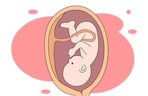 孕晚期胎头在哪里,孕晚期怎么保持头位图1