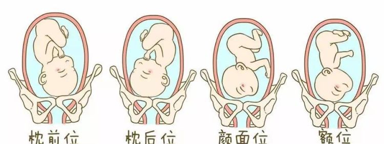 孕晚期胎头在哪里,孕晚期怎么保持头位图3